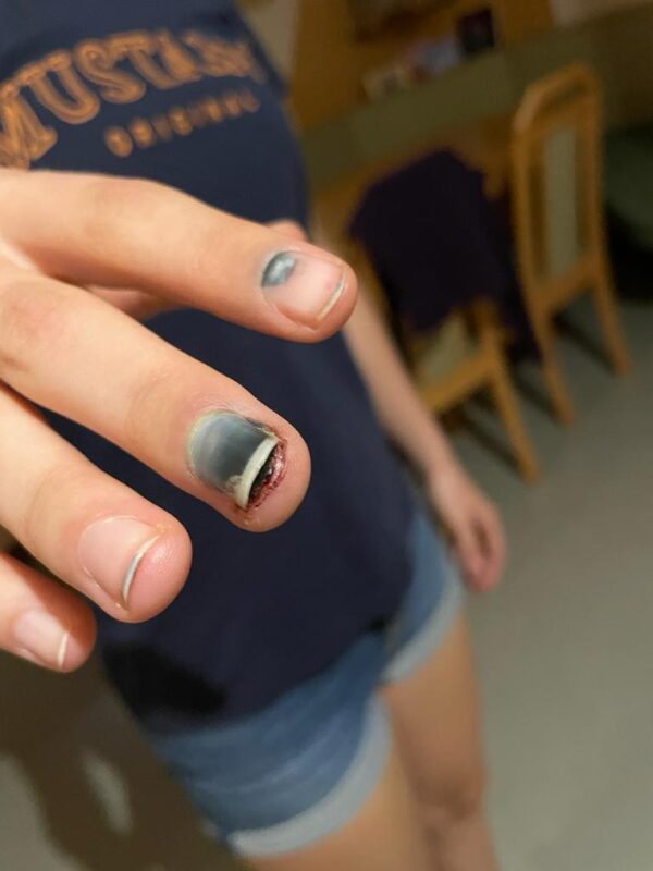 Erfahrungsbericht von Vanessa vanessa finger 2